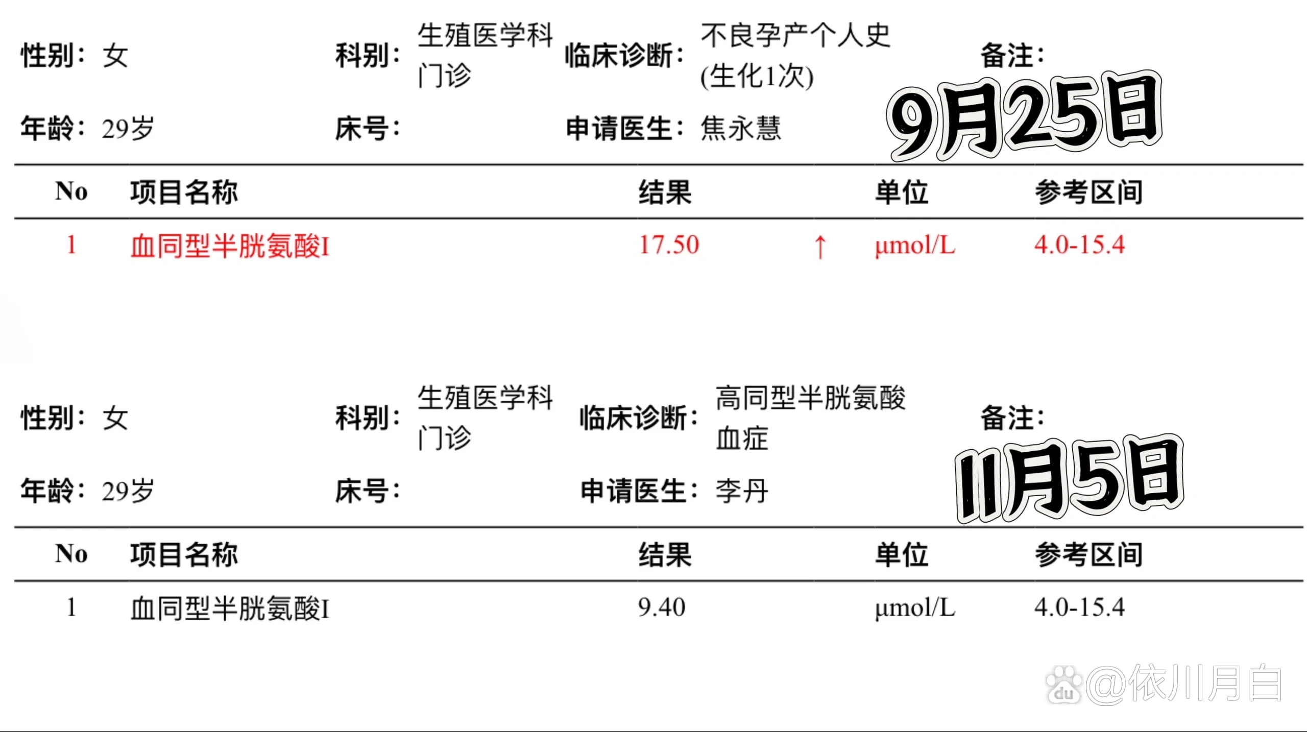同型半胱氨酸高是怎么回事