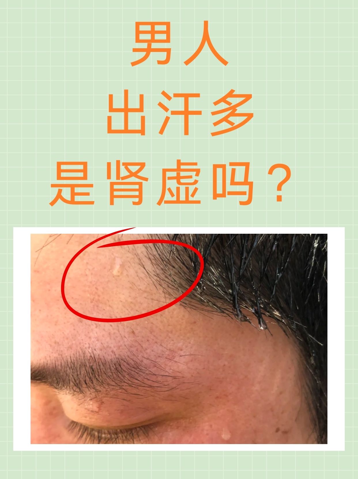 男人晚上睡觉出汗是怎么回事