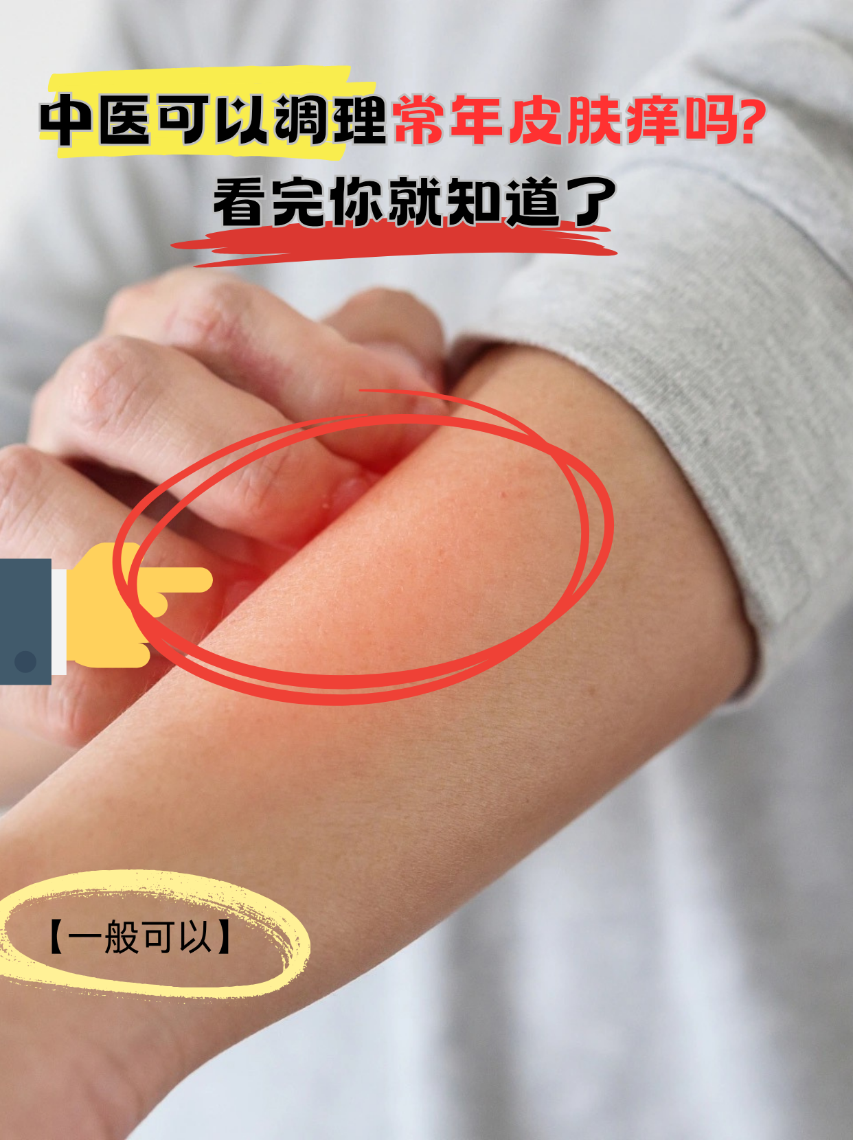 痒.像针扎一样