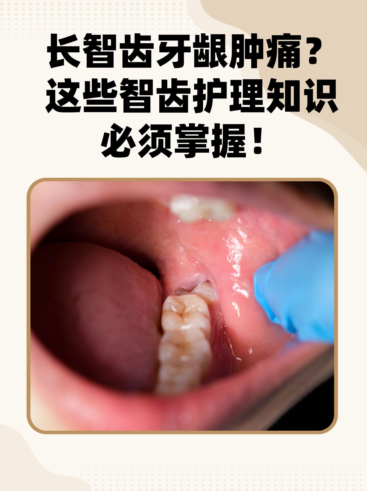 牙龈疼痛怎么治疗