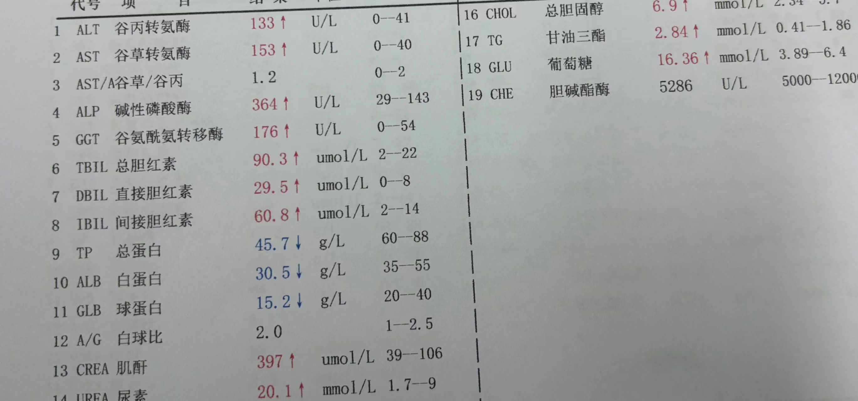 谷草谷丙偏高代表什么