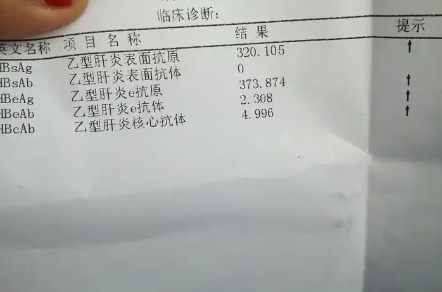 乙肝大三阳夫妻传染吗?
