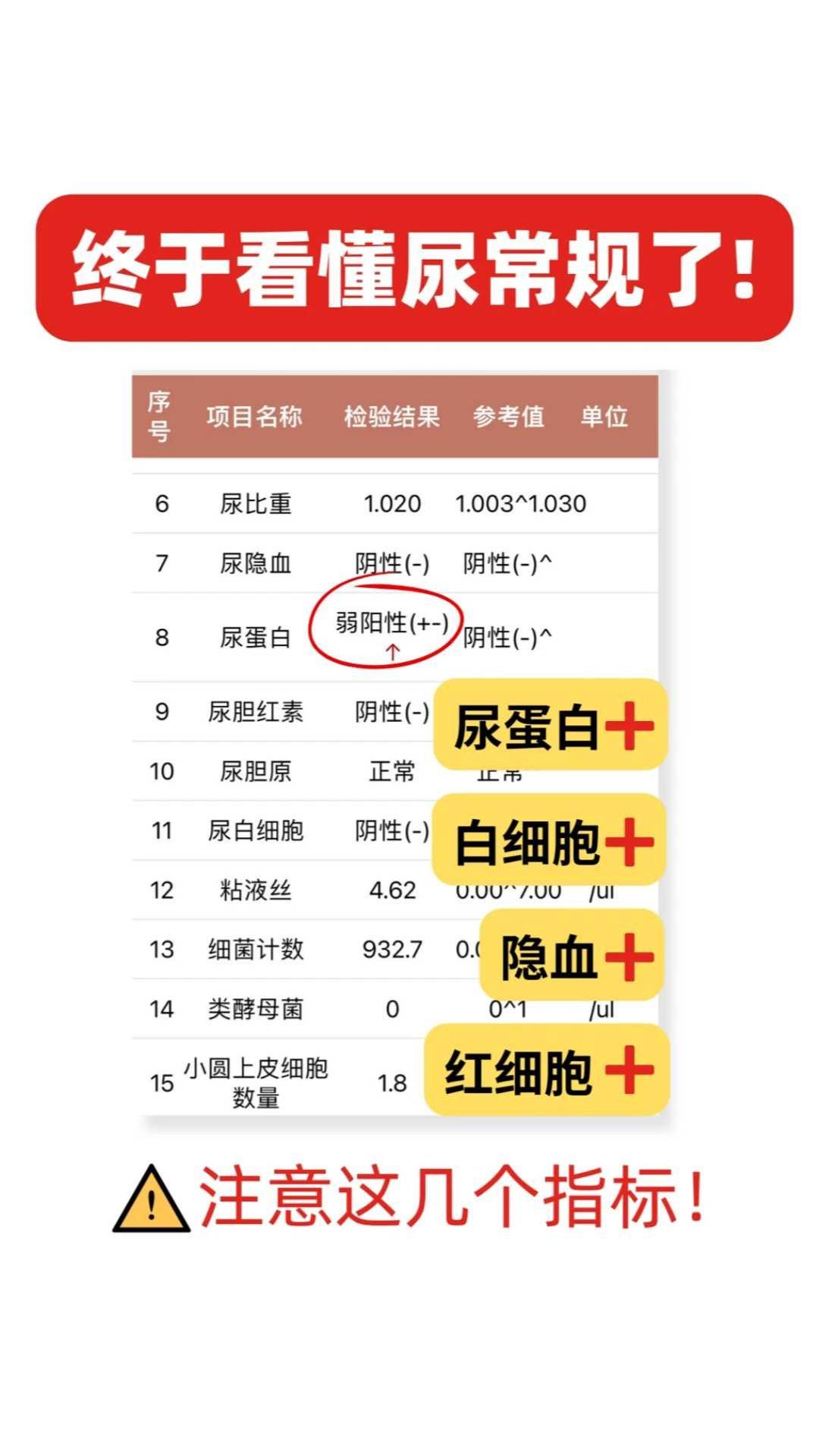 做尿常规要多少钱