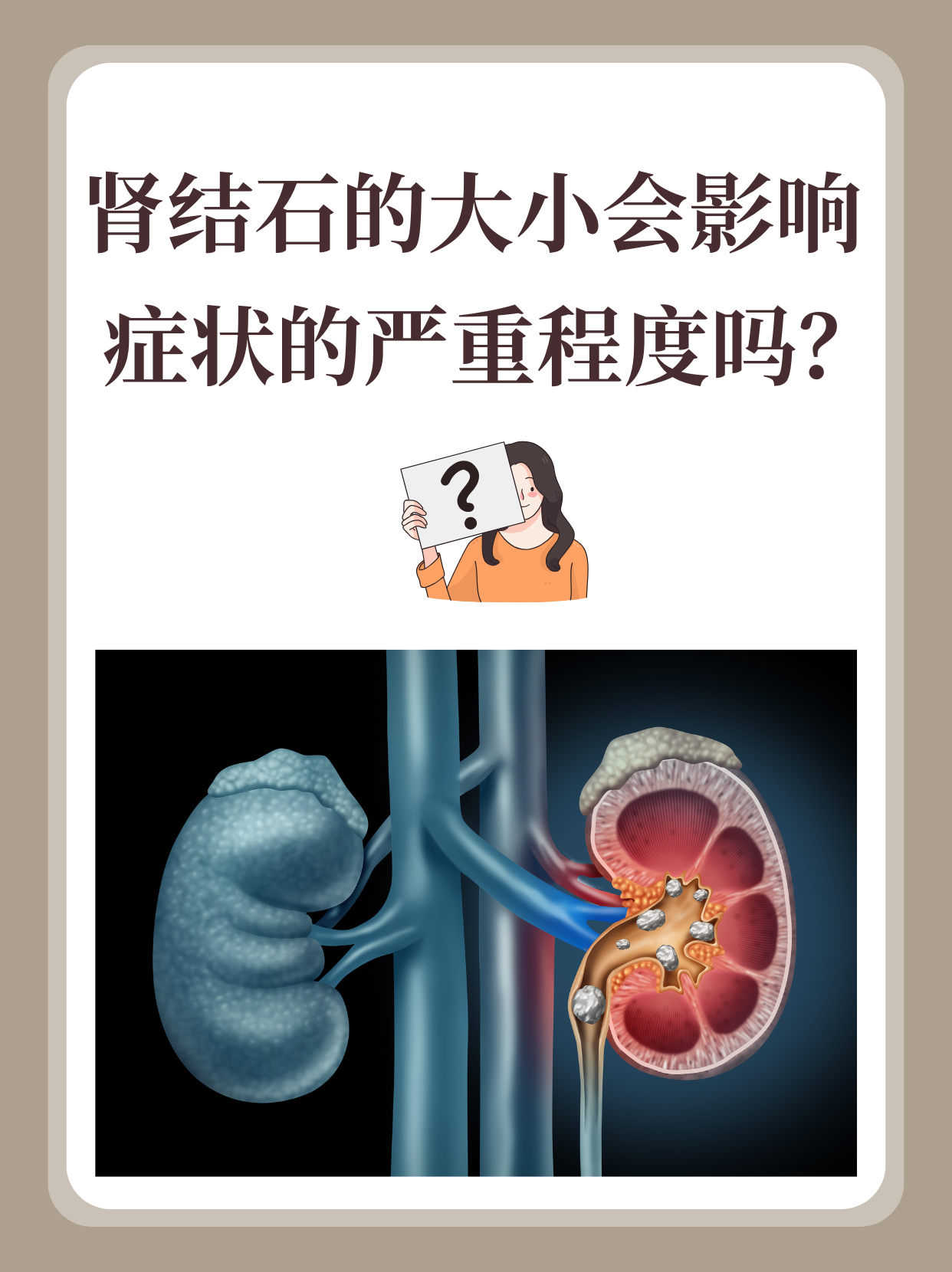 肾结石怎么形成的