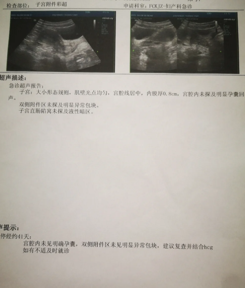 宫外孕可以药流吗?