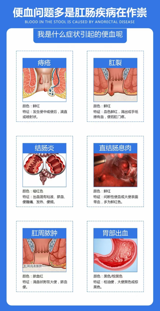 痔疮大便出血怎么办