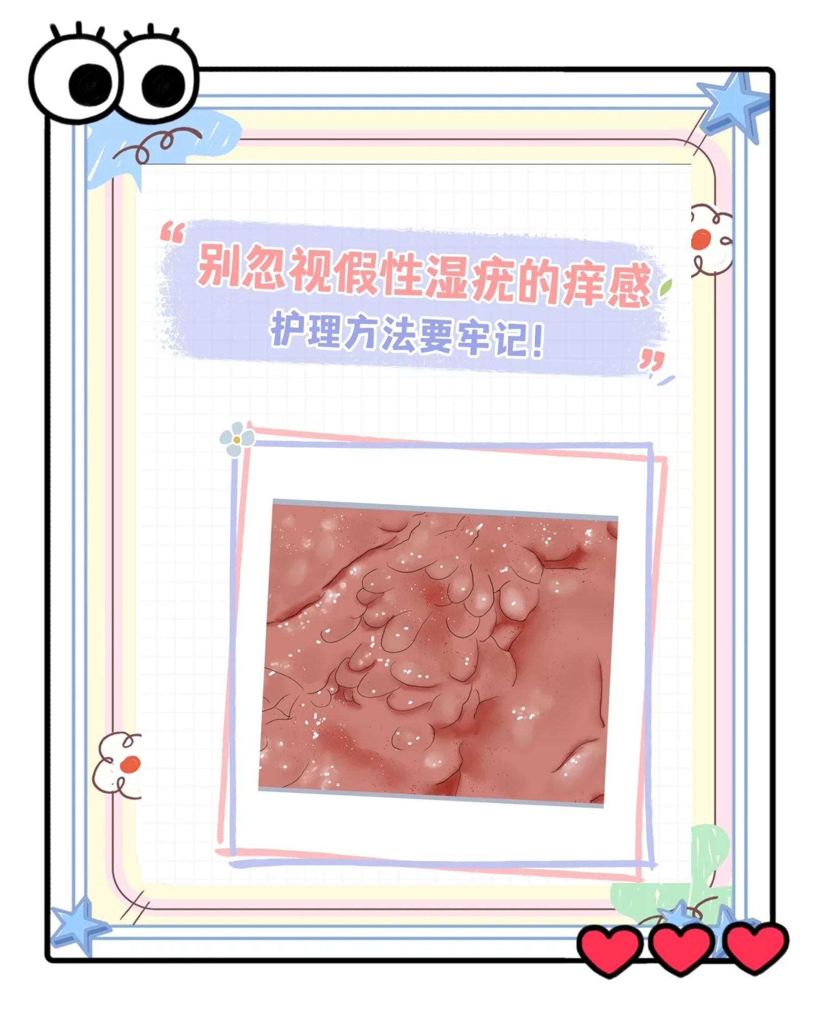 尖锐湿疣痒吗