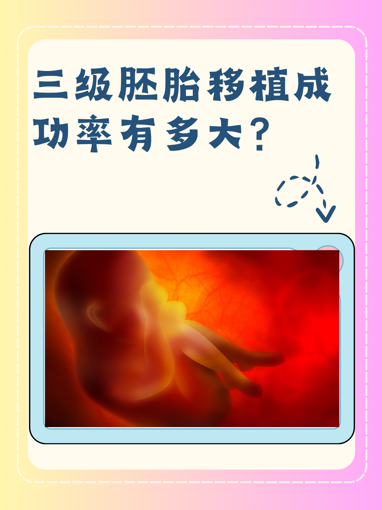 试管婴儿的成功率是多少?