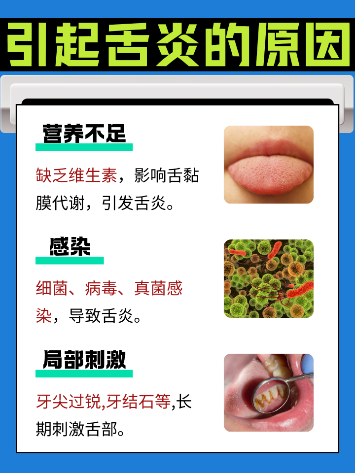 舌头疼怎么治疗