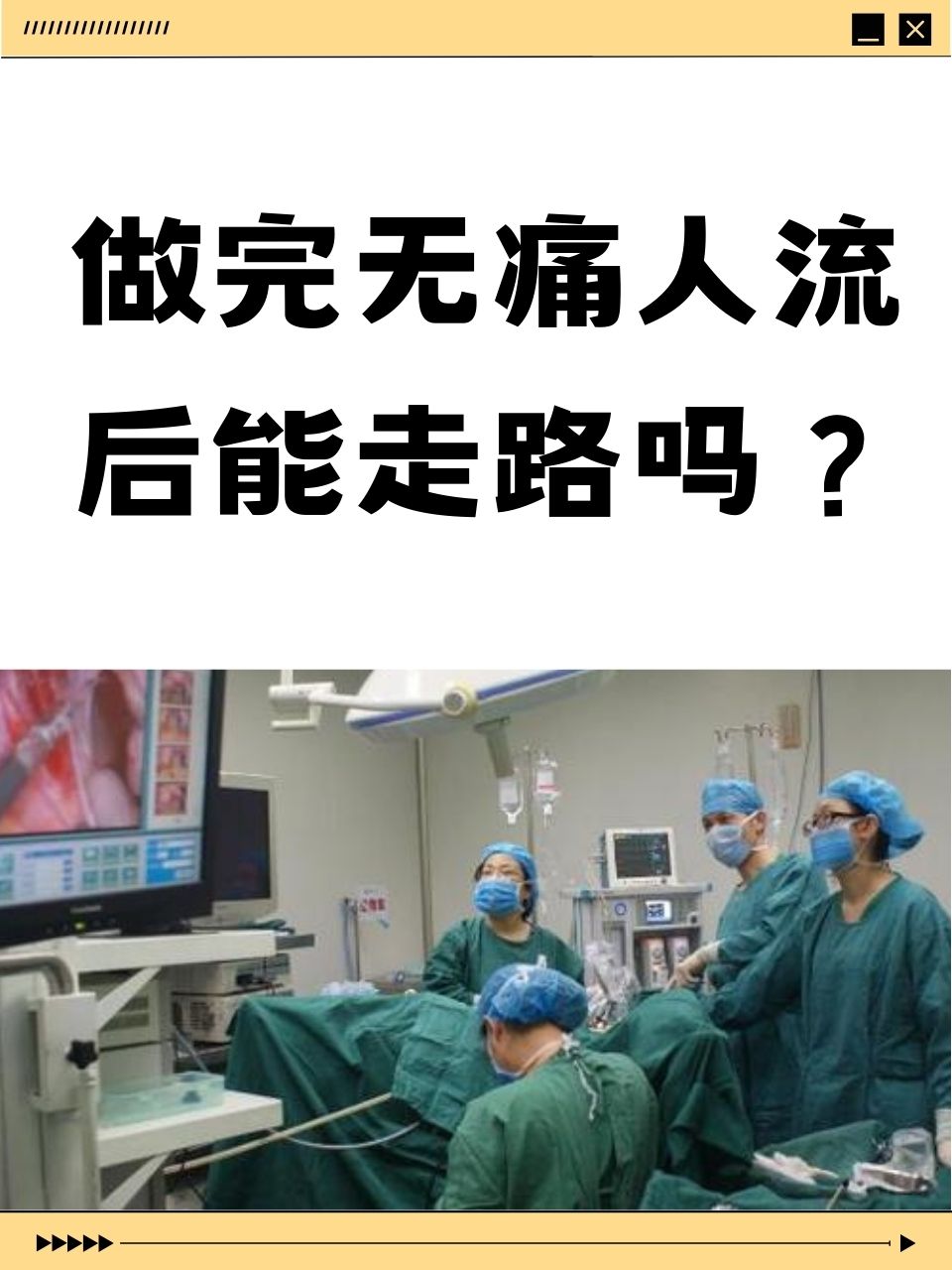 什么是无痛人流?