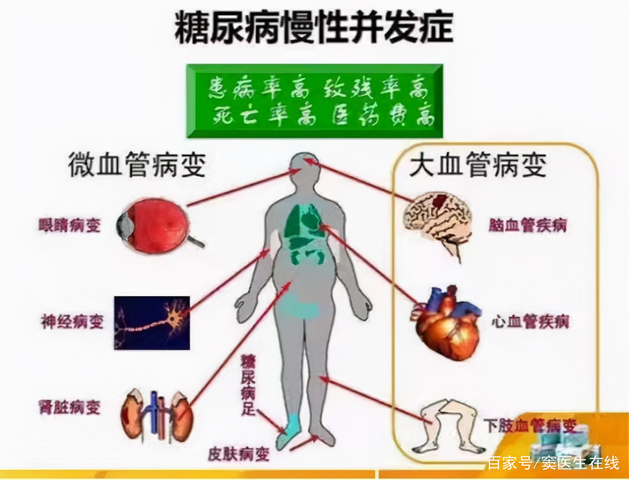 什么是糖尿病