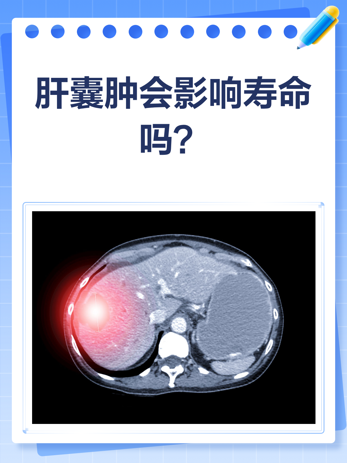 肝囊肿会自动消失吗