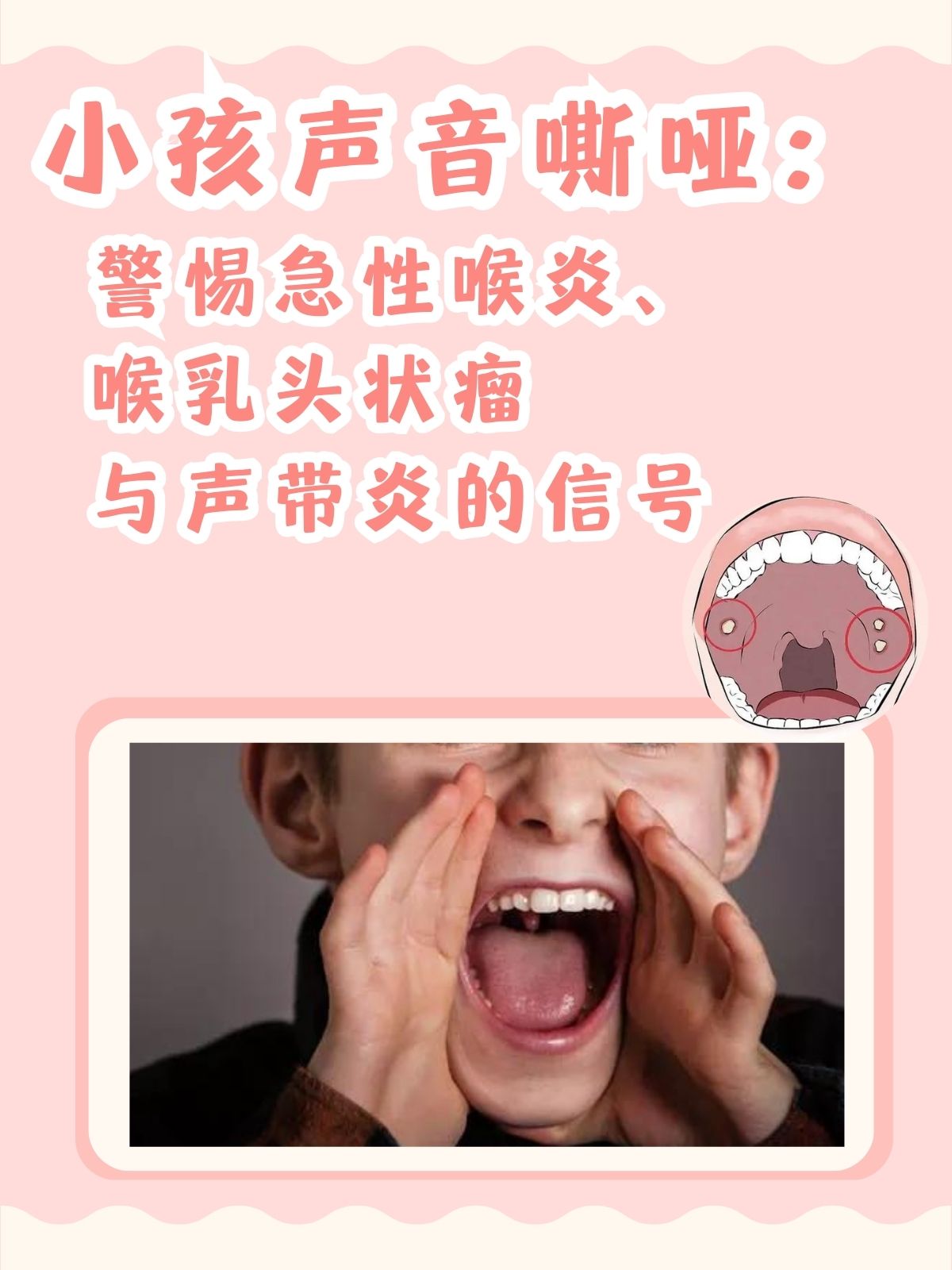 嗓子哑了是怎么回事
