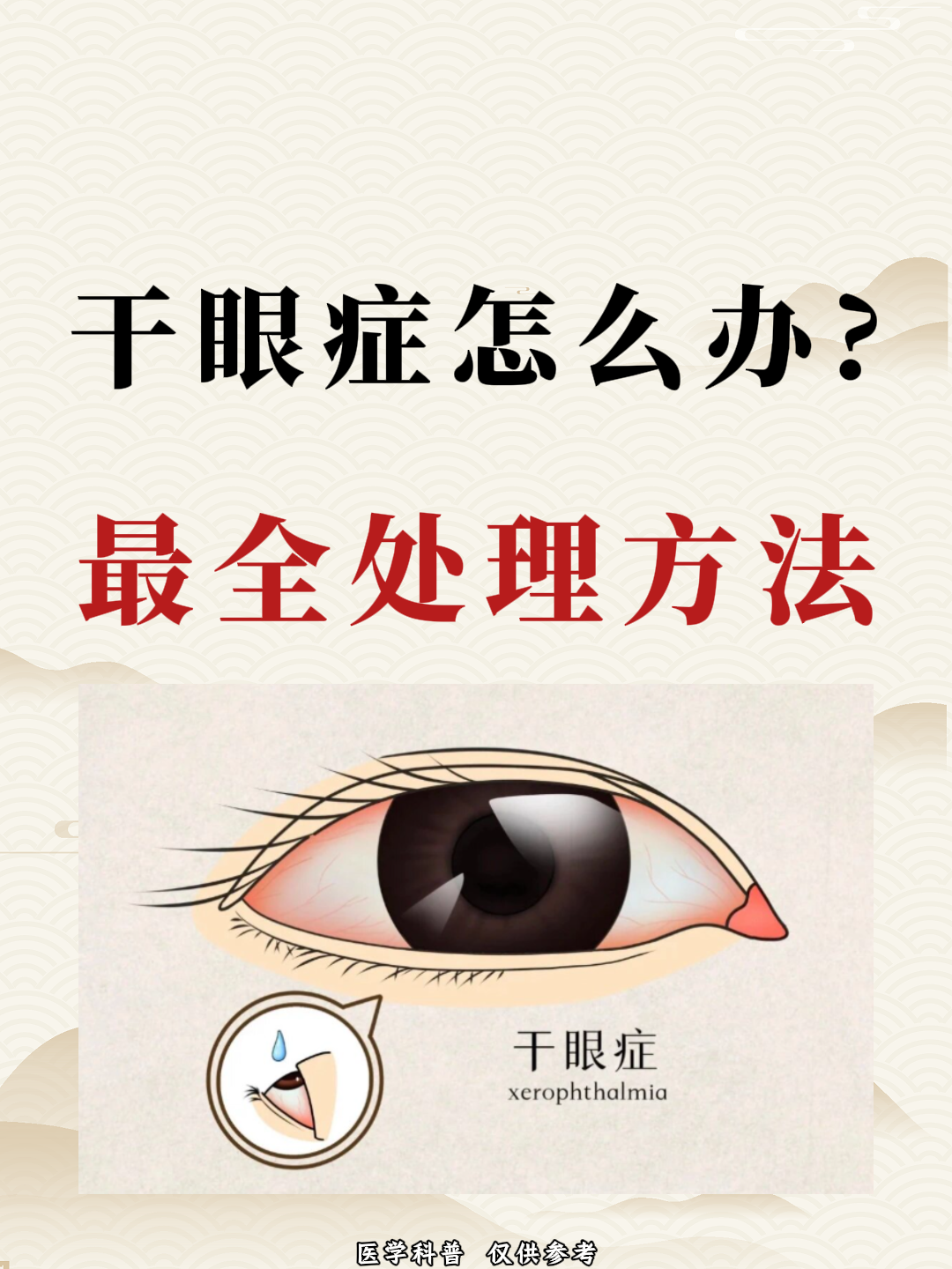 干眼症是由什么原因起的?
