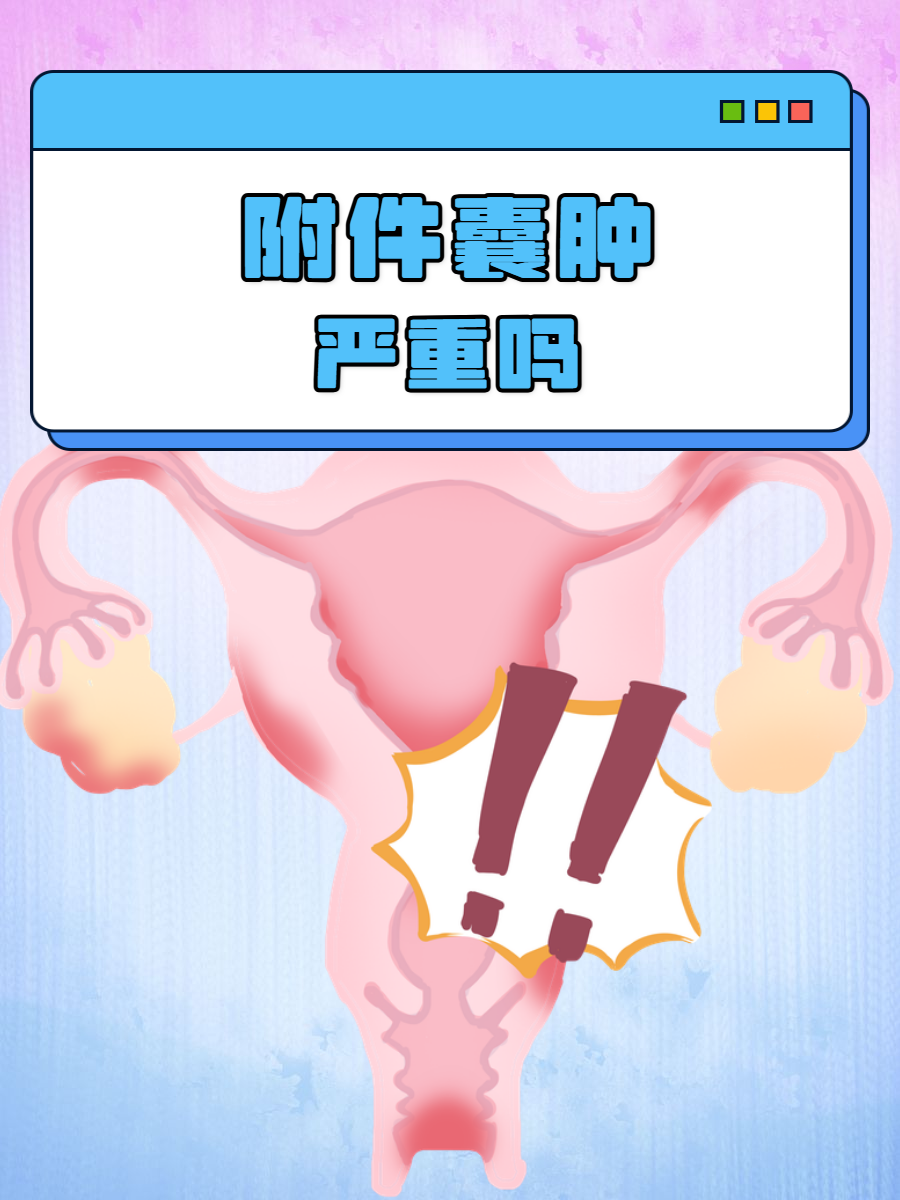 右侧附件区囊肿严重吗?