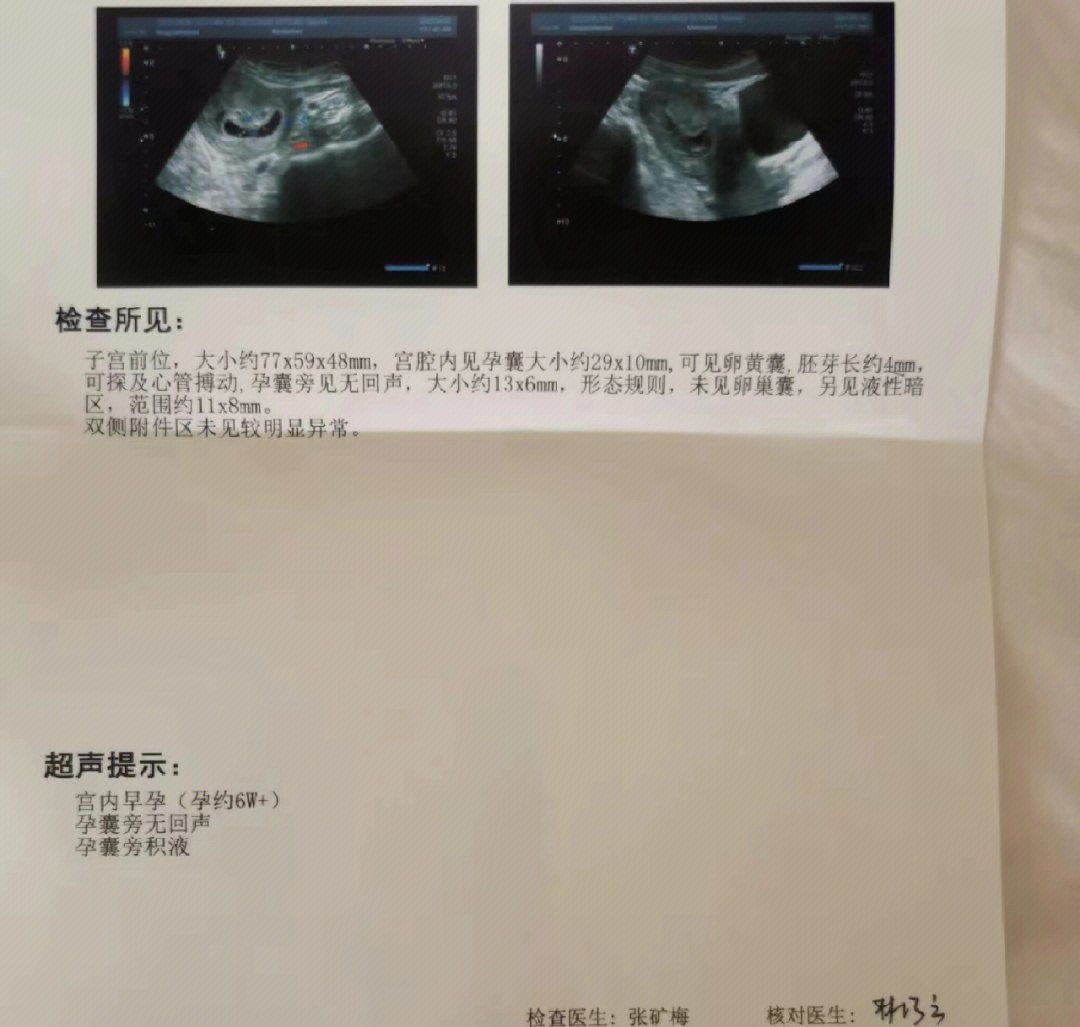 做无痛人流需要家长签字吗