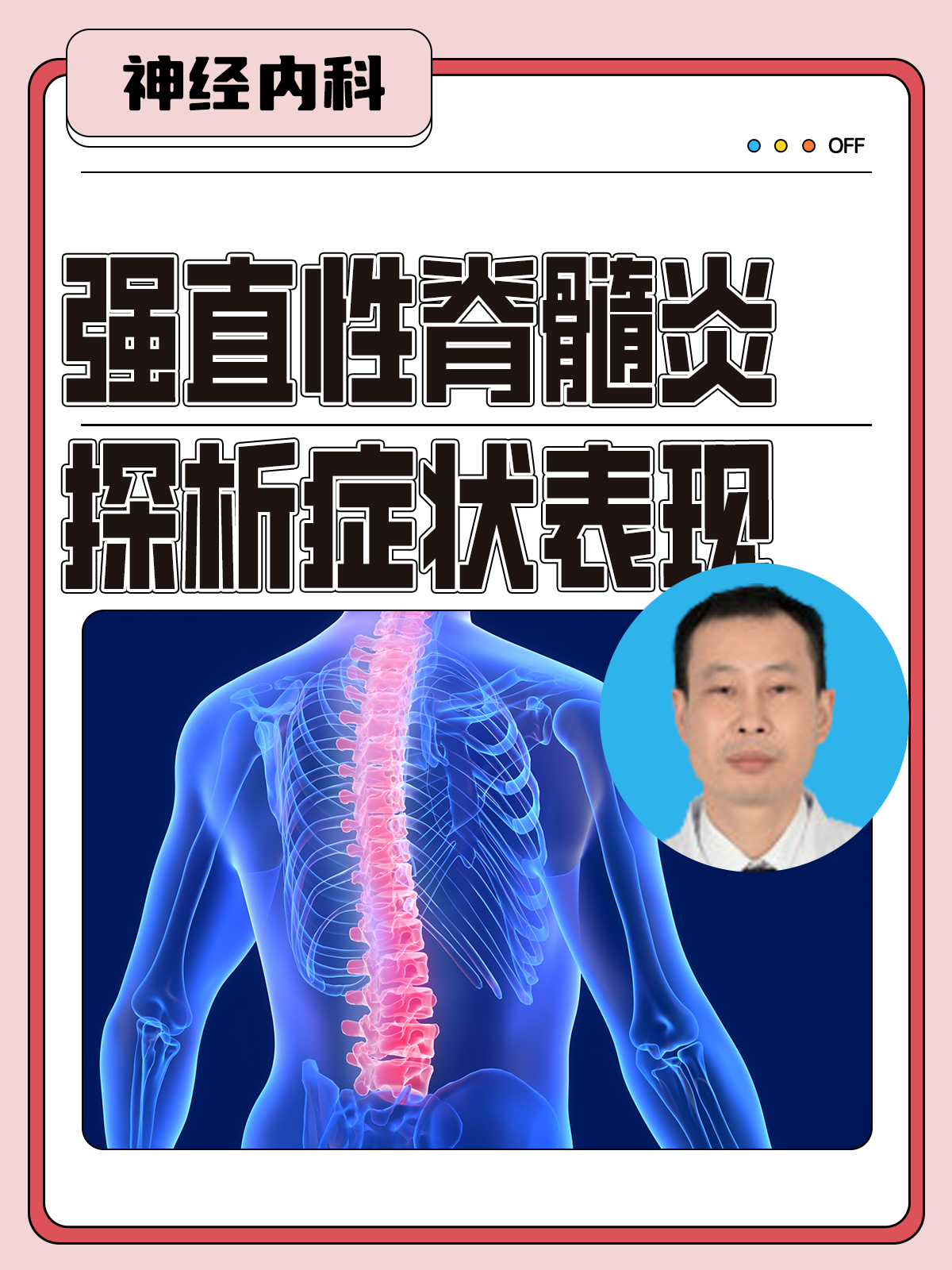 脊椎炎的症状有哪些