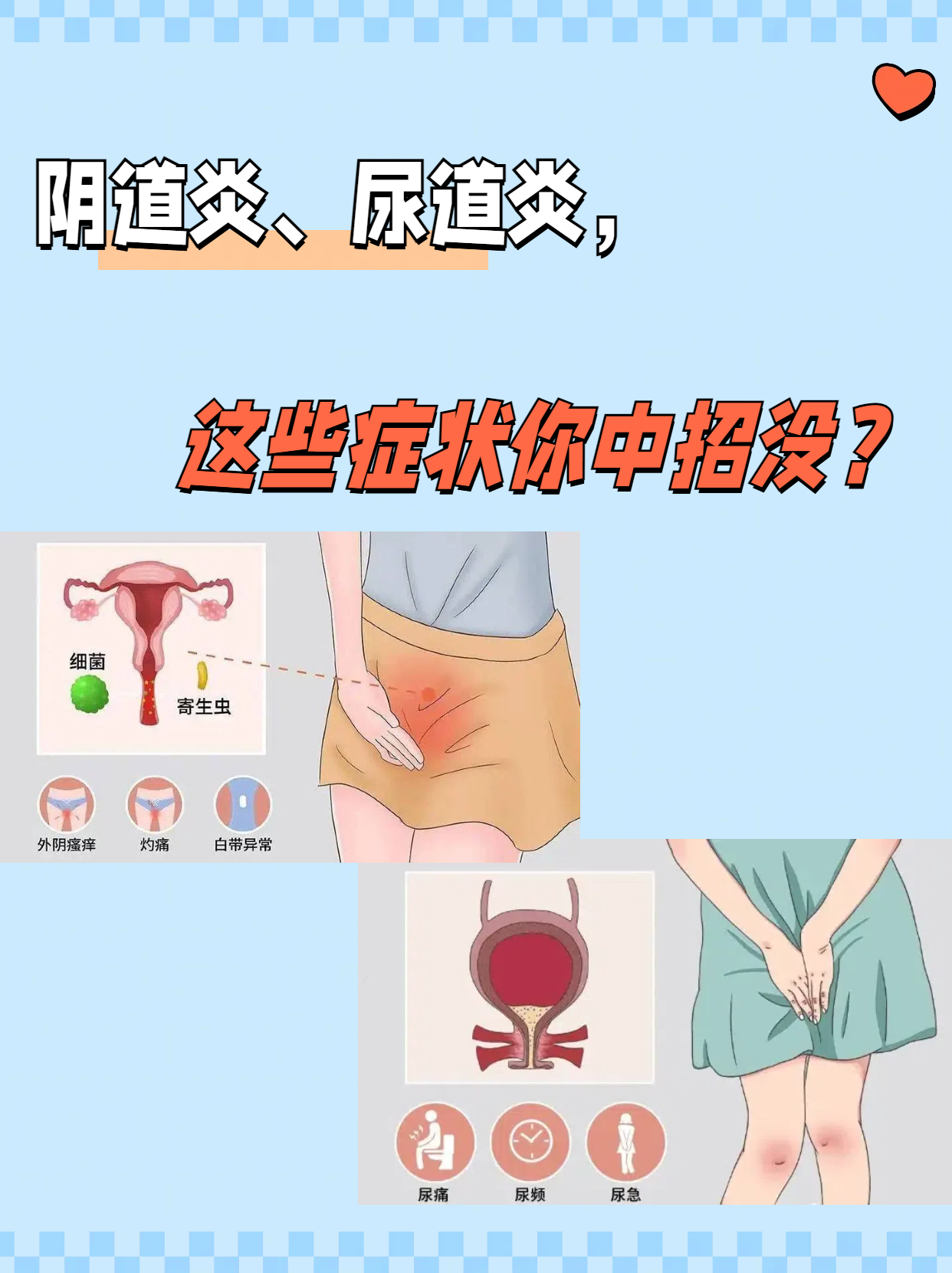 尿道炎的症状是什么?