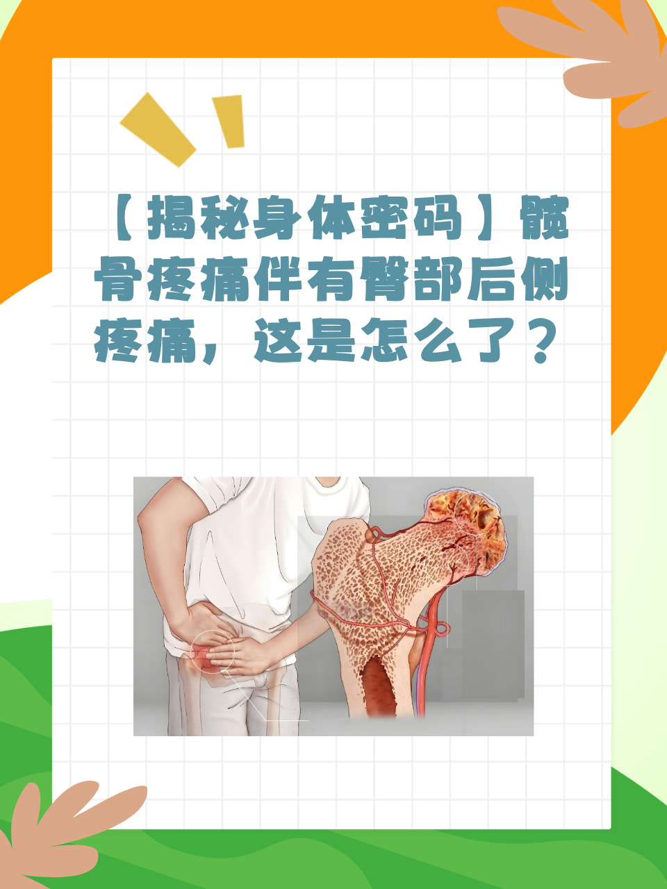 什么是髋关节骨性关节炎?