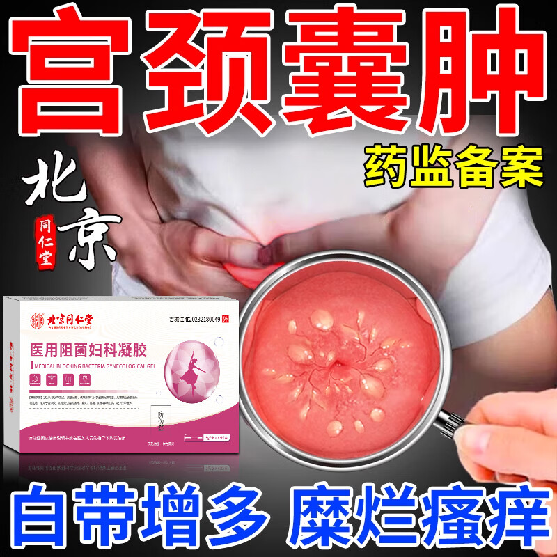 宫颈有囊肿怎么办