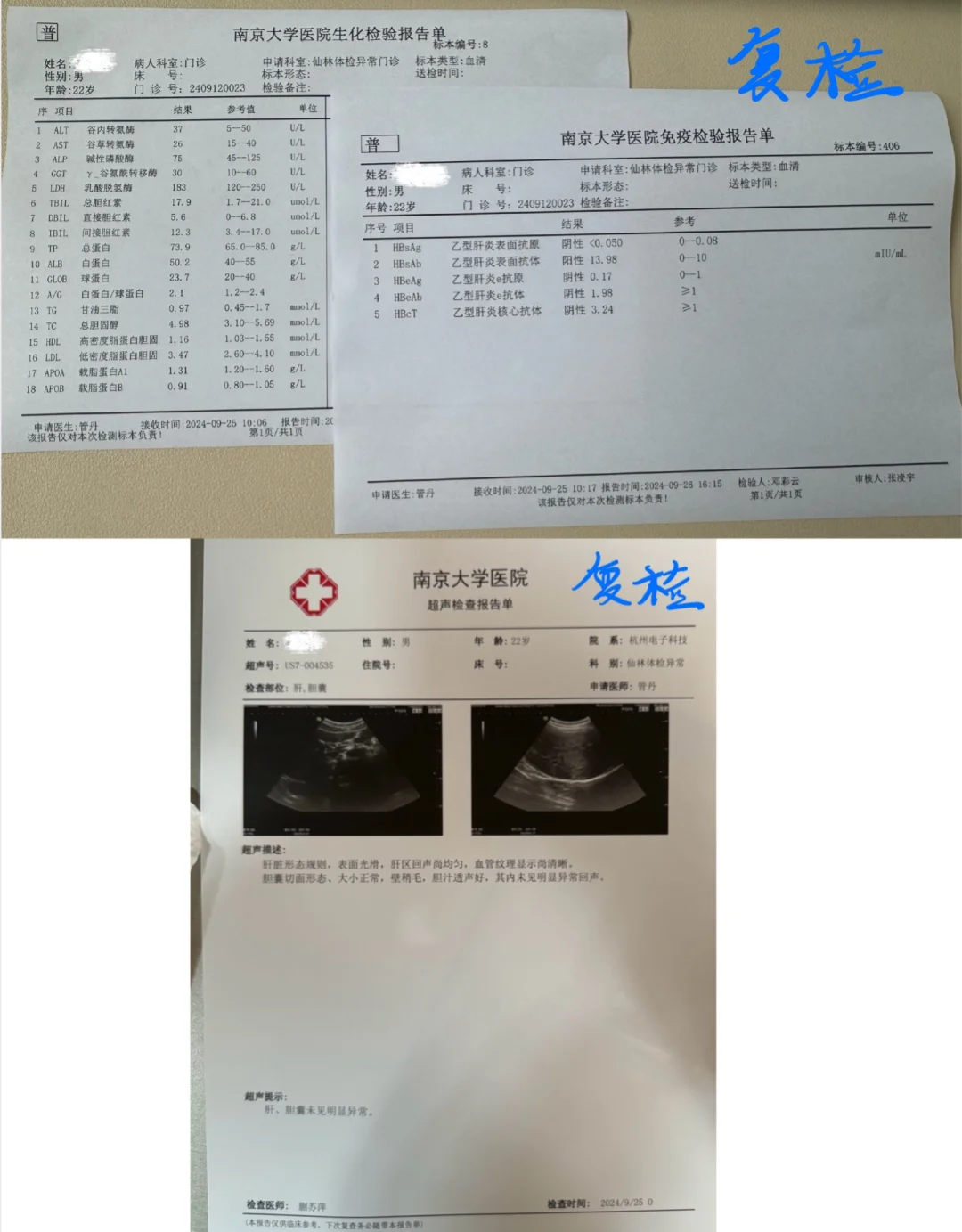 谷丙转氨酶49算高吗
