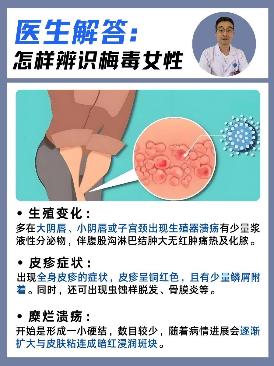 女性梅毒的早期症状有哪些