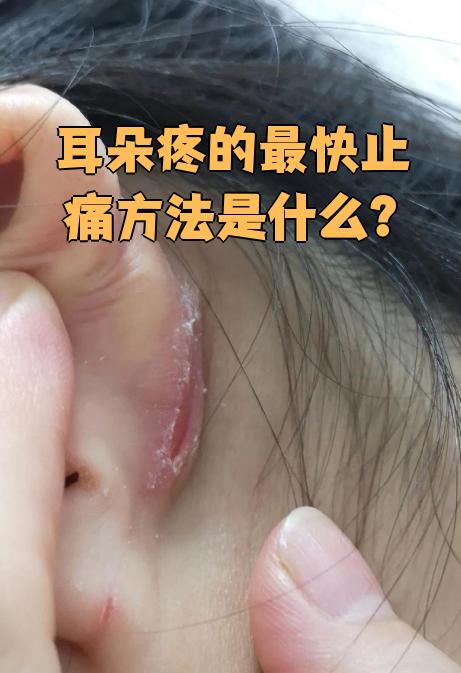 吃东西的时候耳朵旁边疼
