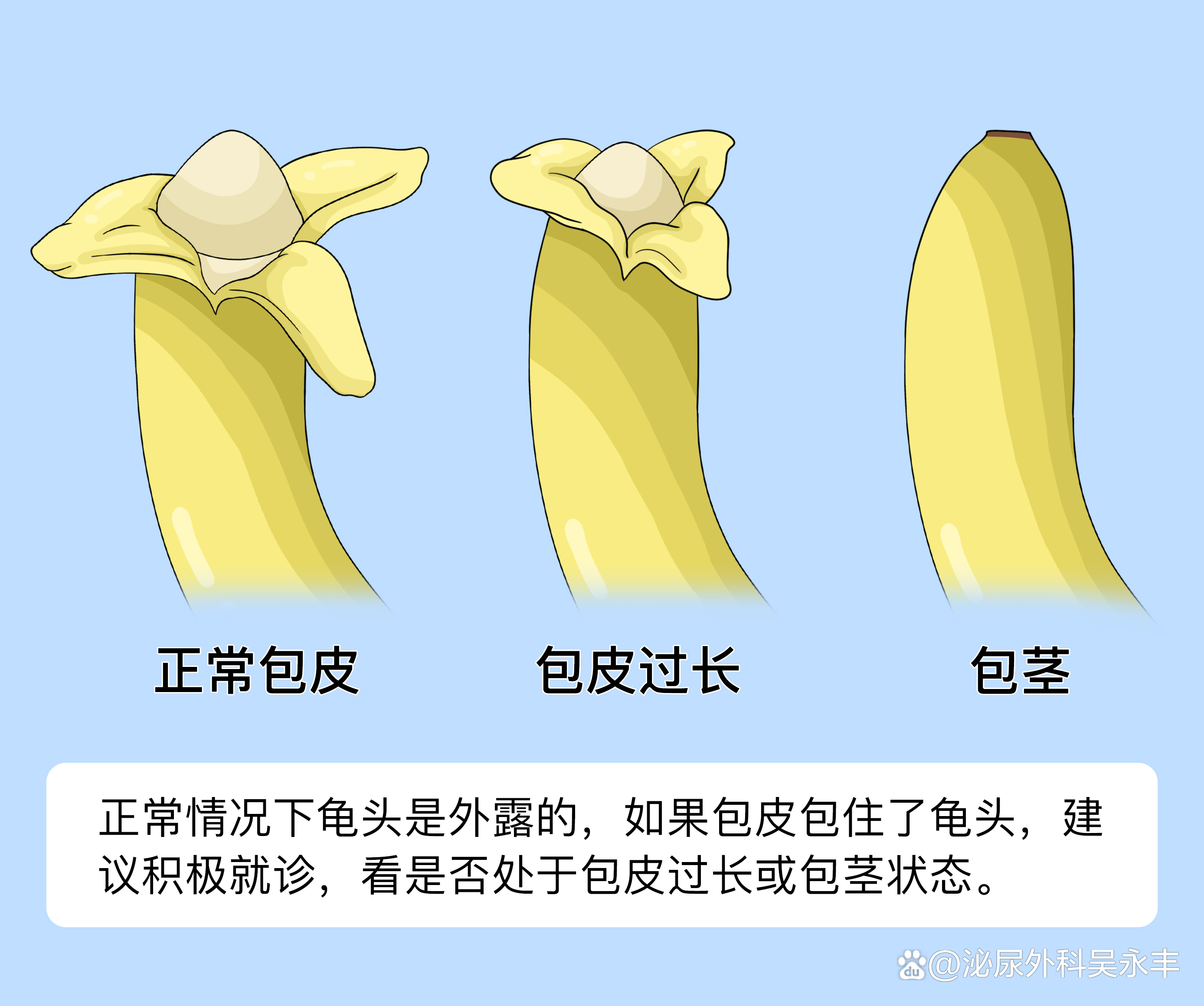 什么是包皮？包皮图片是什么样的？