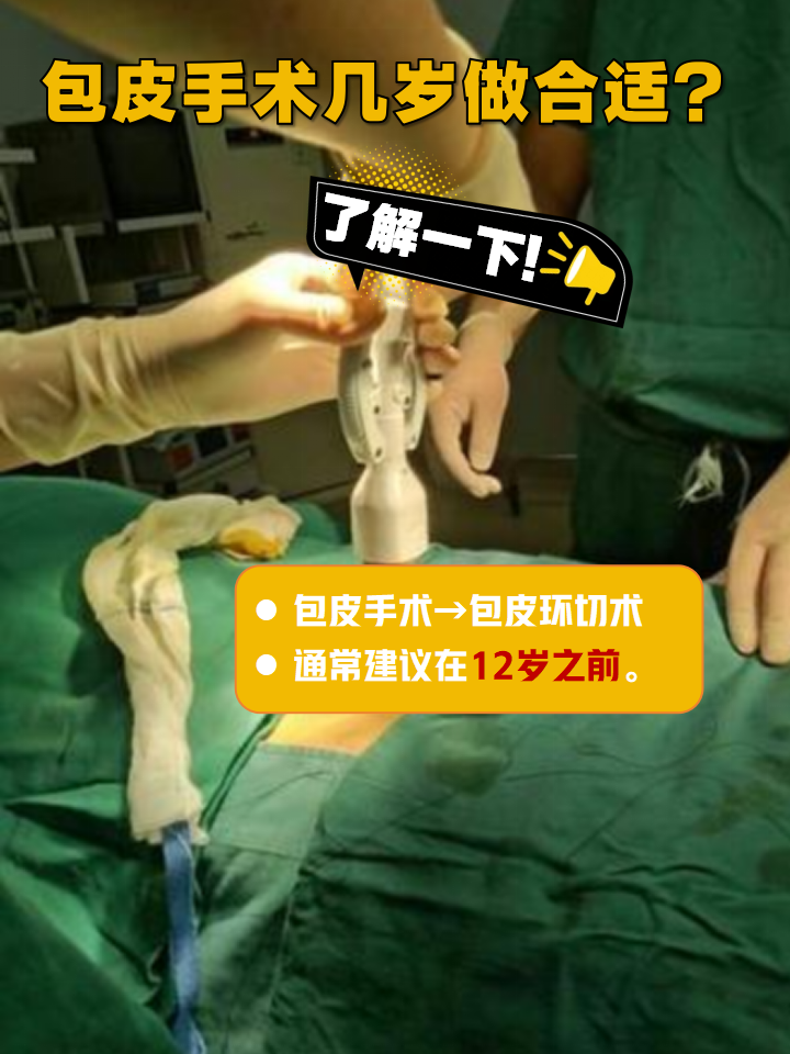 韩式环切包皮手术