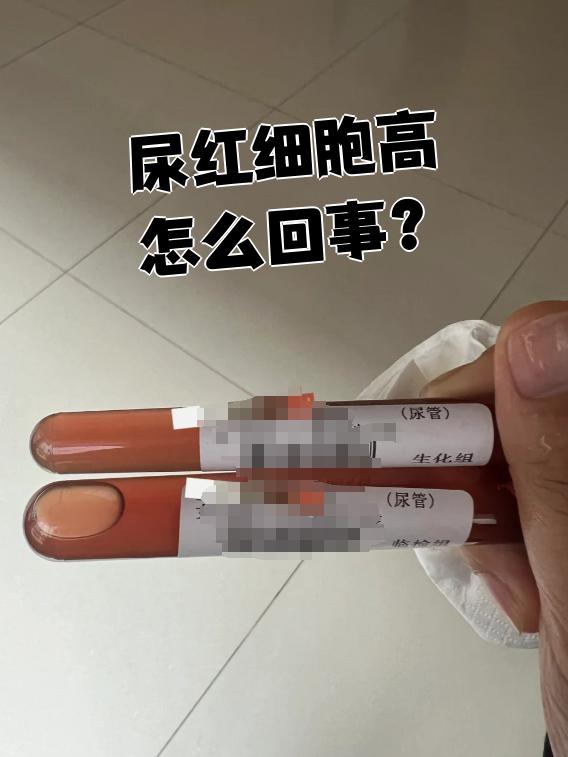 尿检红细胞高是怎么回事