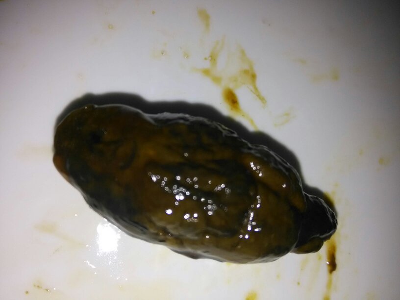 拉屎是黑色的是怎么回事