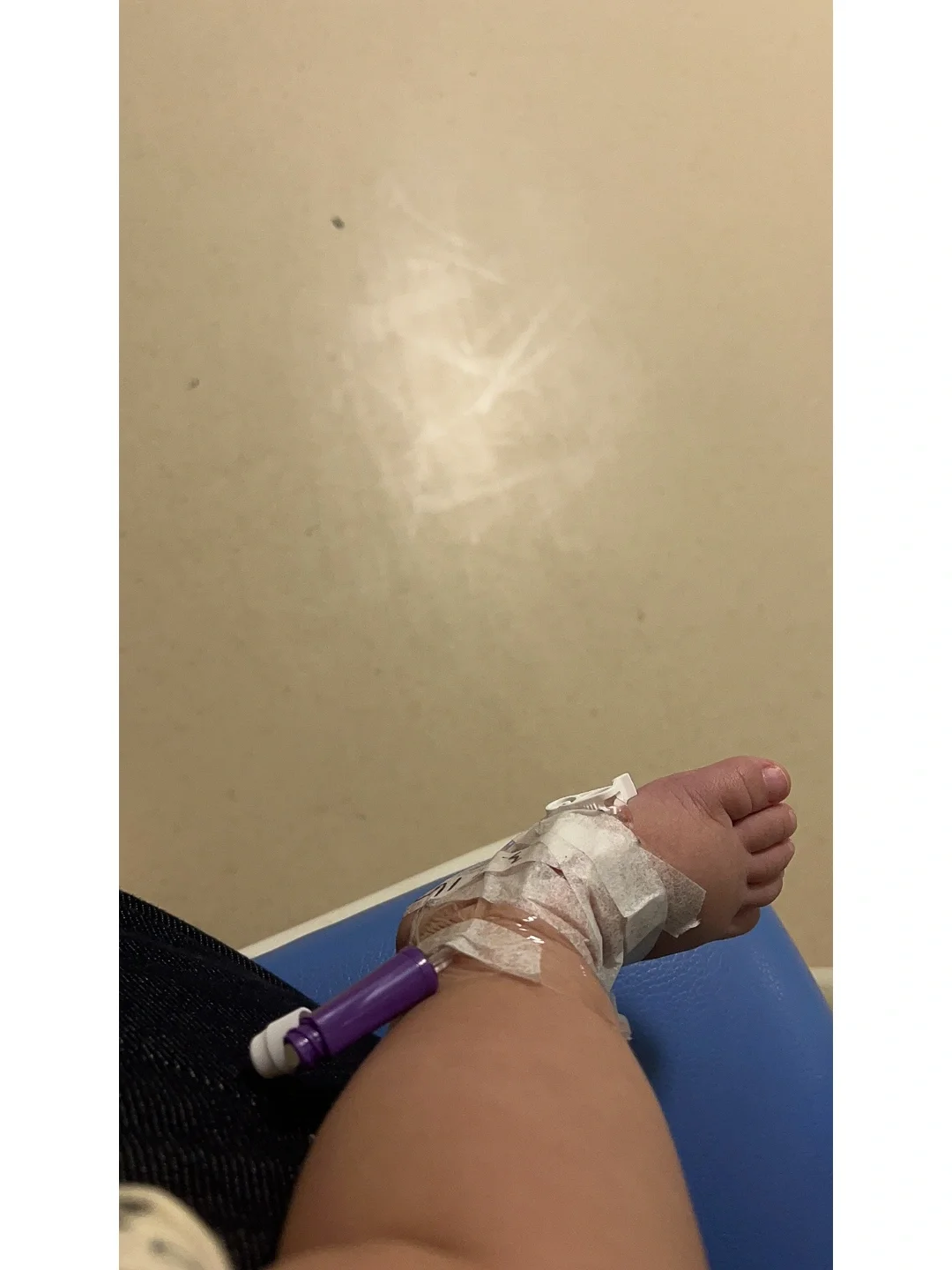 宝宝支气管肺炎恢复期的症状
