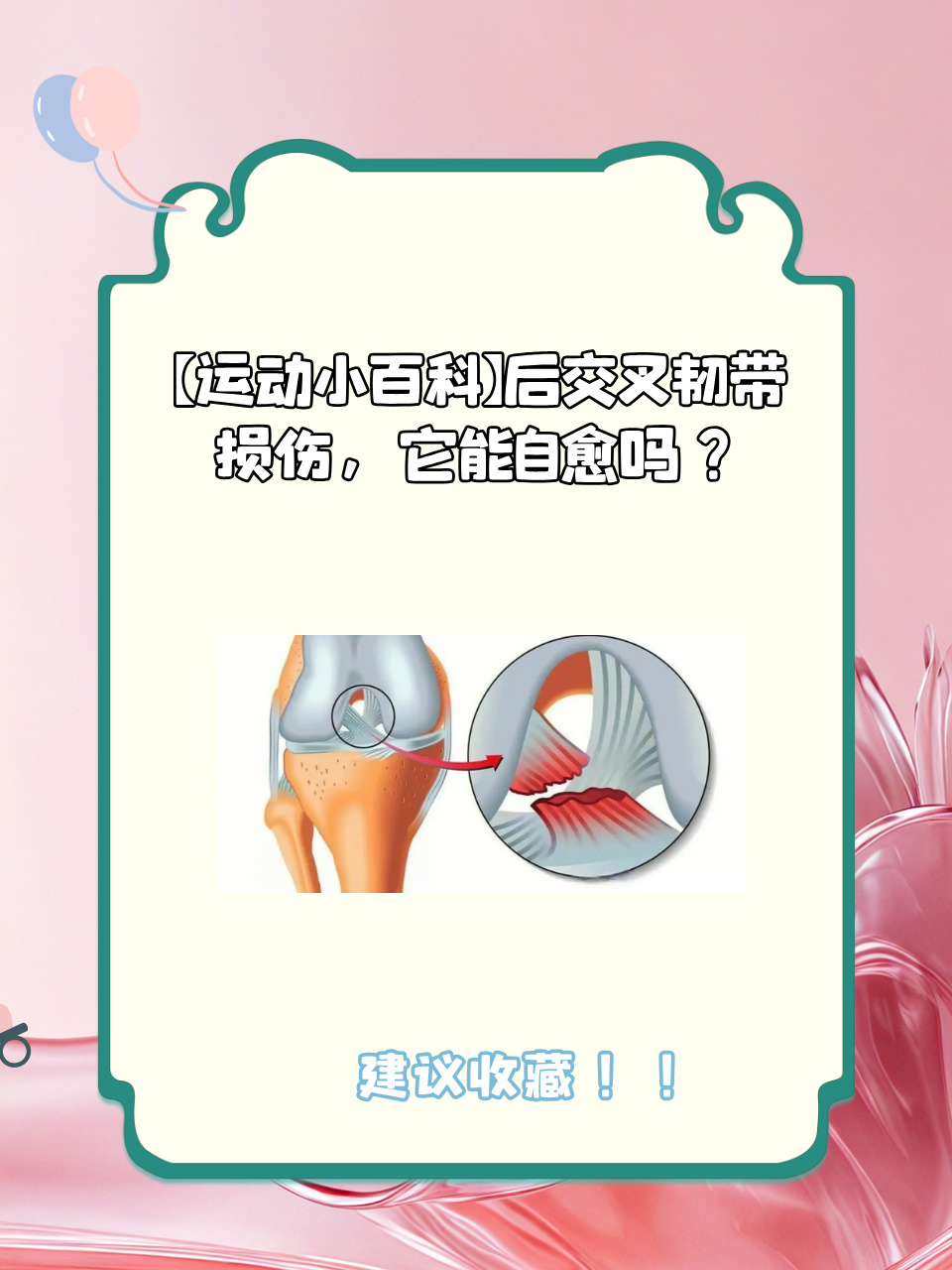 膝盖韧带拉伤怎样恢复快