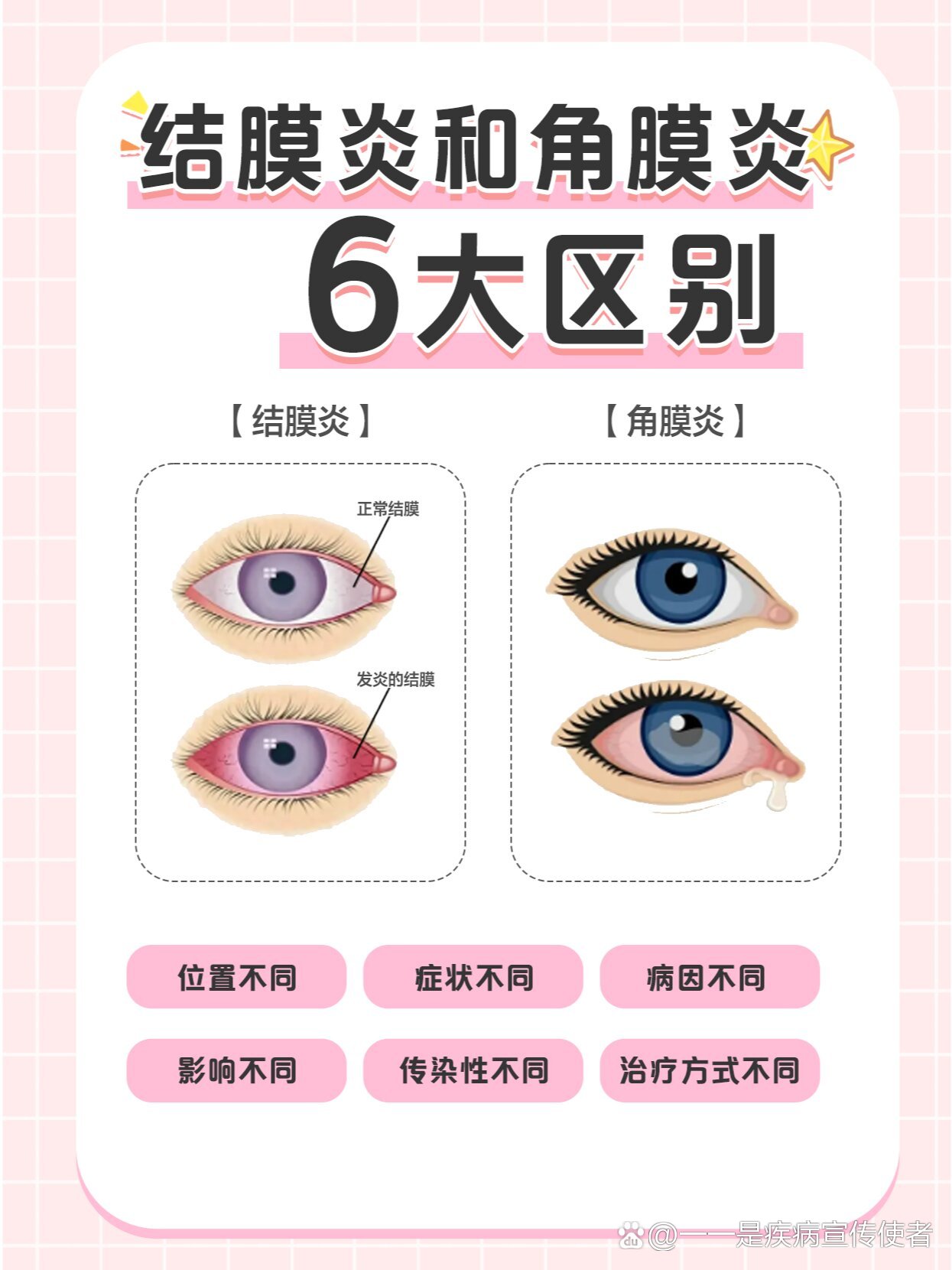 什么是角膜炎?