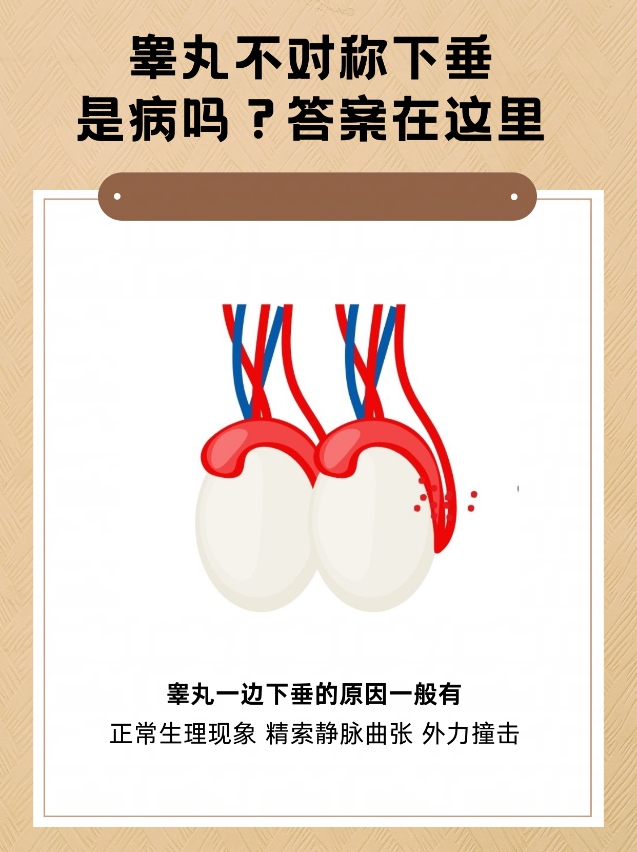 左右睾丸不对称是怎么回事?