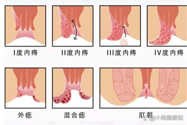 疏运升 第3页
