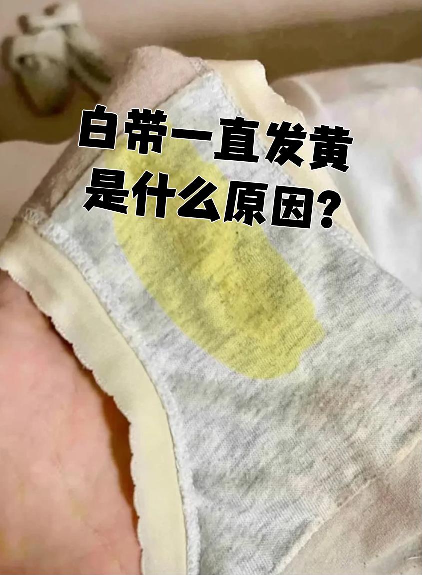 白带多,干了后发黄