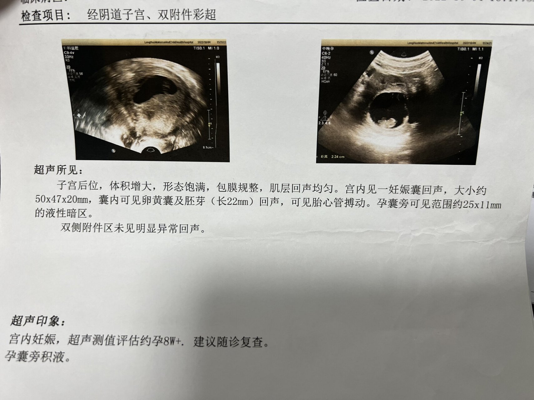 怀孕一个月时,彩超单上说宫内可见大小分别