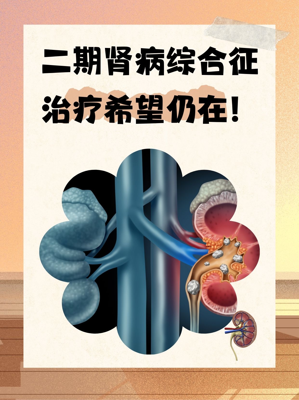 肾病综合征严重吗