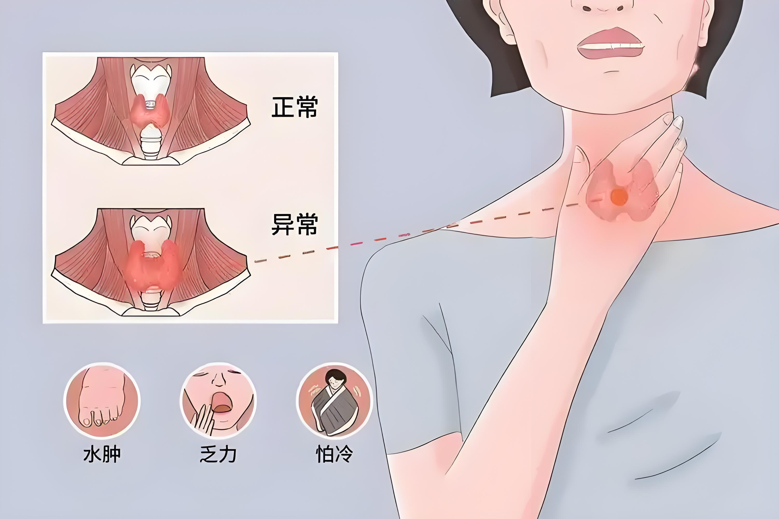 女性甲减的症状