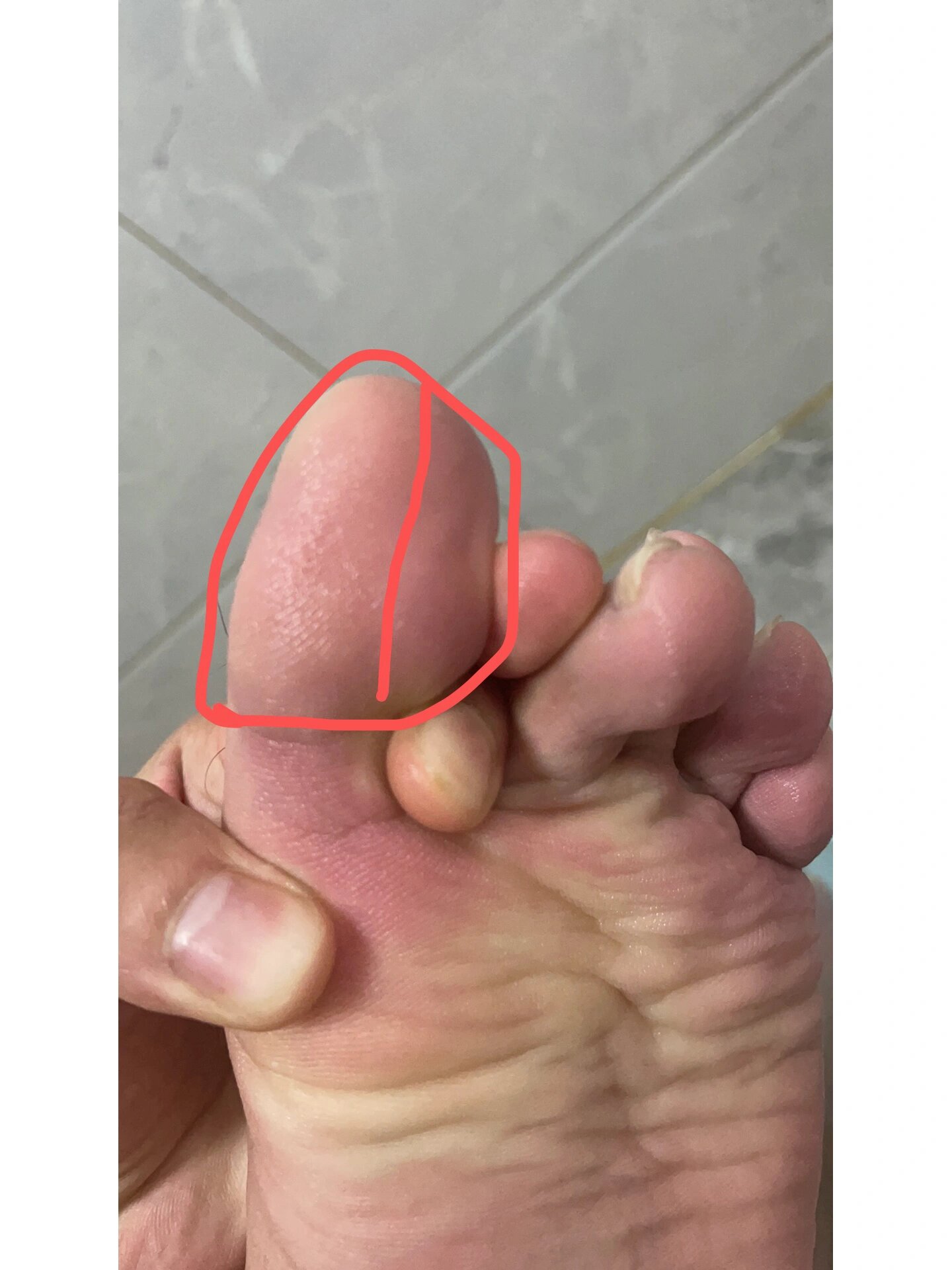 左脚大脚趾发麻,是什么原因