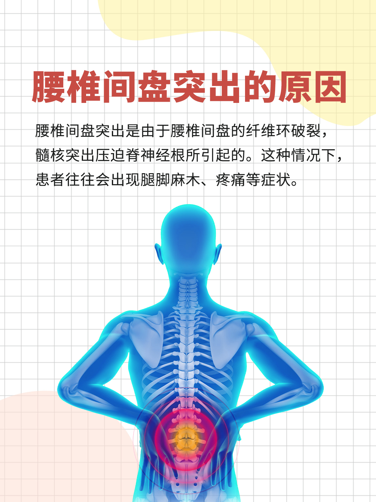 腰椎间盘突出怎么办啊