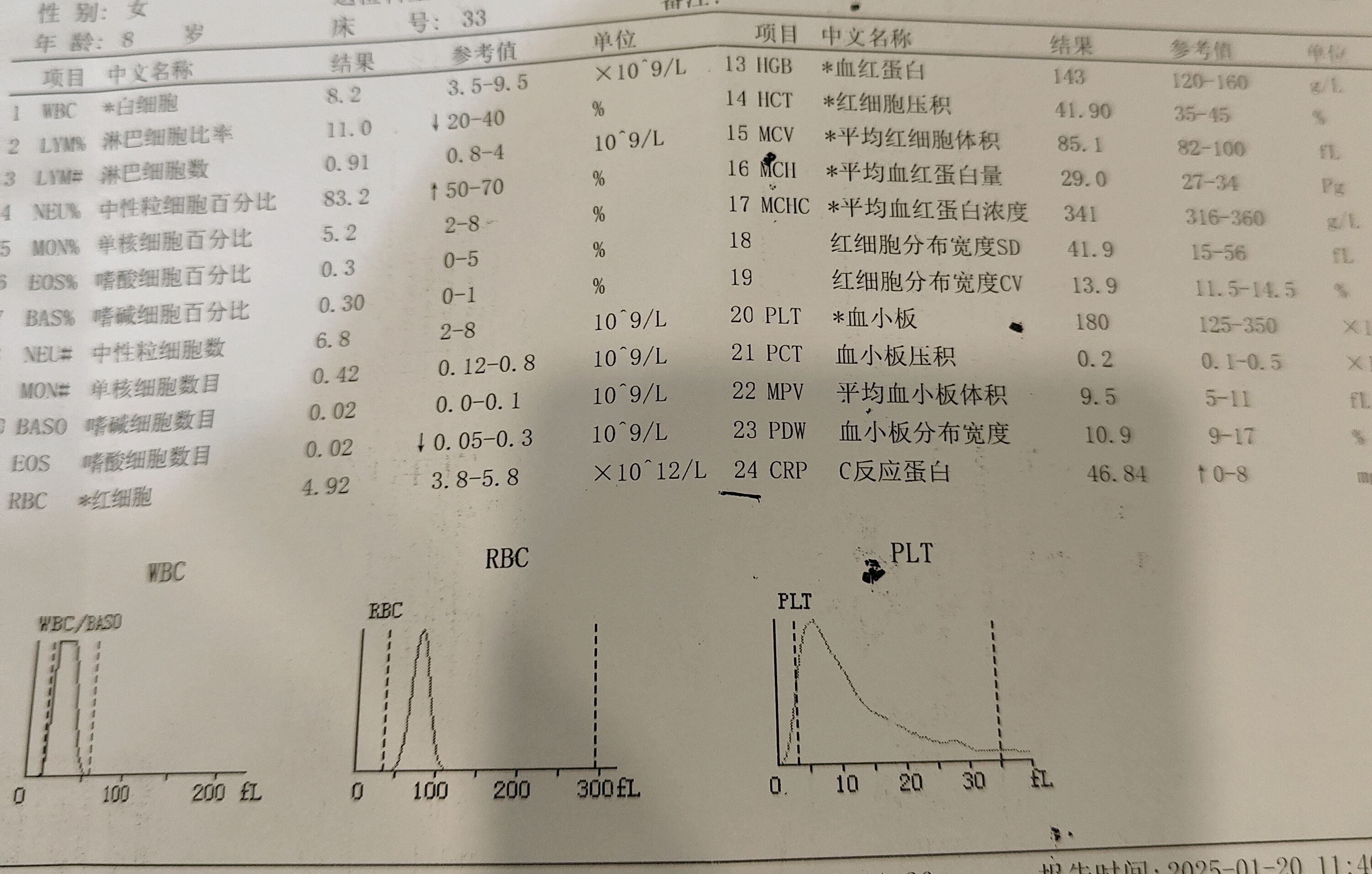 血常规白细胞偏低有什么影响