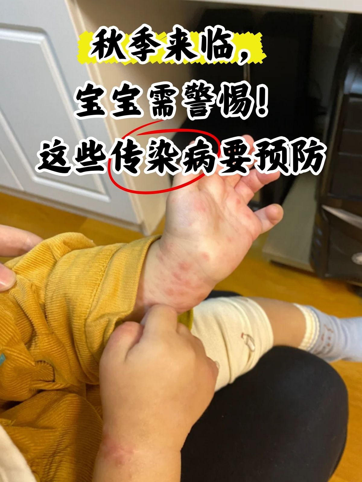 孩子流感发烧五天了怎么办?