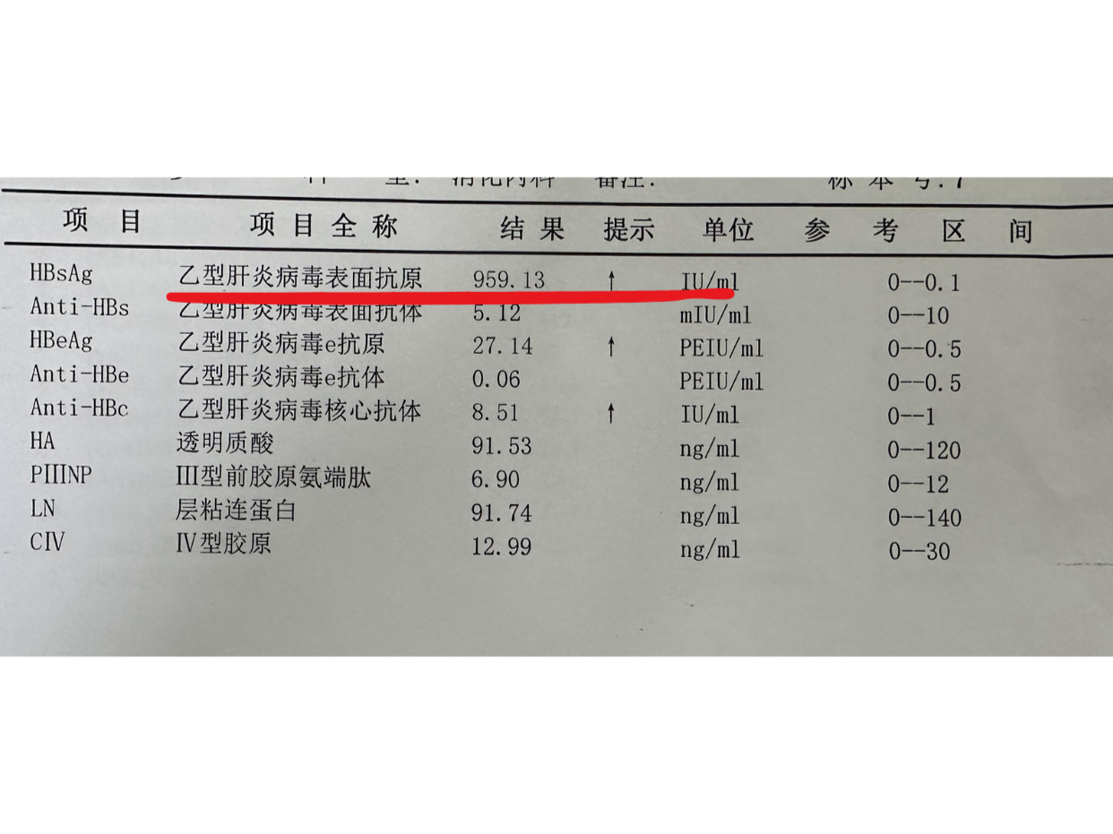 乙肝表面抗体定量是1000是什么意思