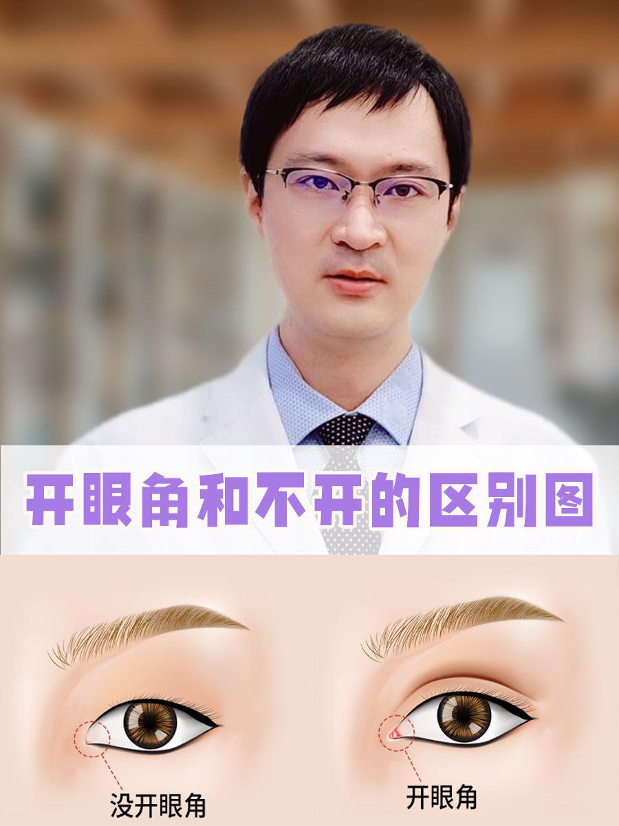 开眼角手术痛吗