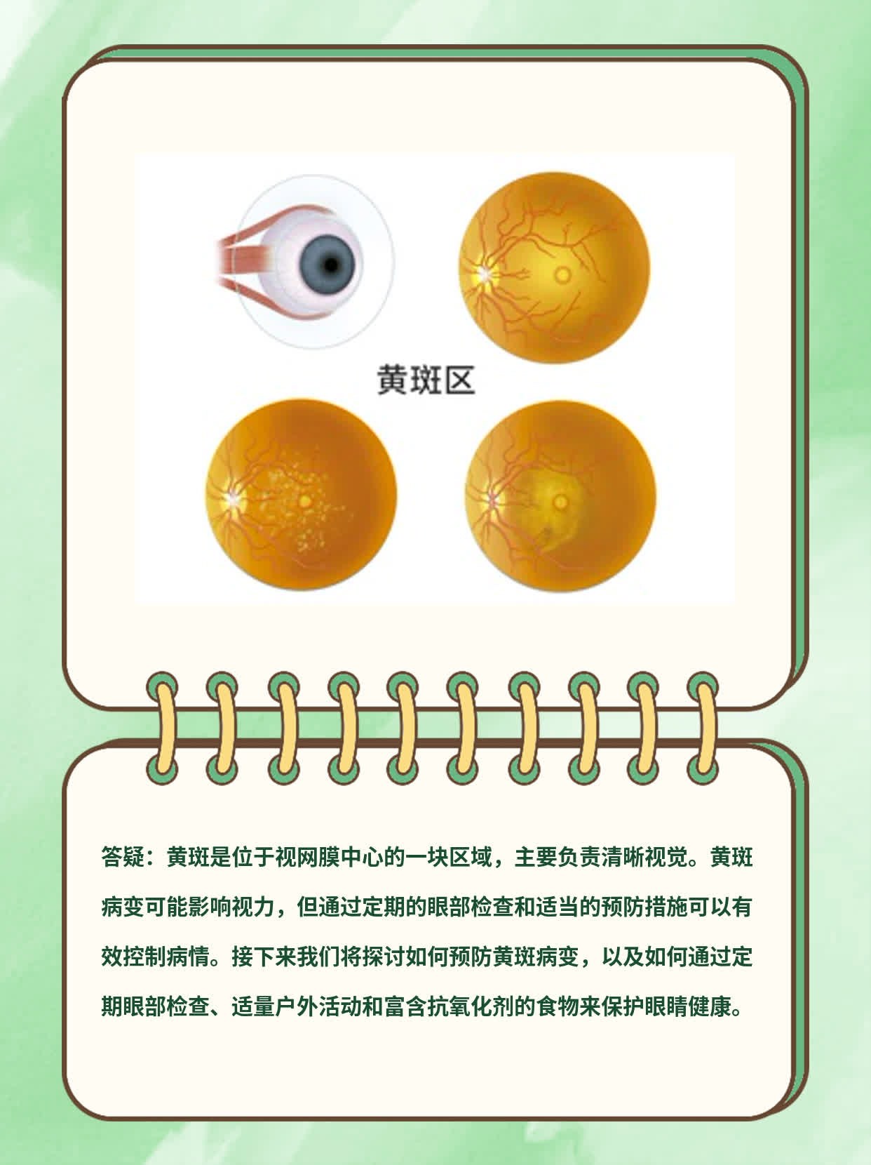 眼睛里有黄斑如何去除