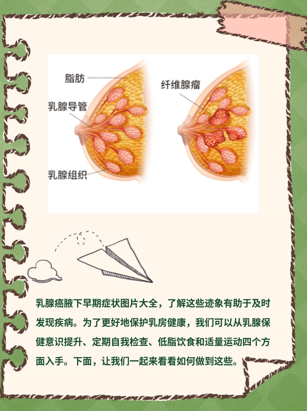 乳腺癌的早期症状都有哪些?