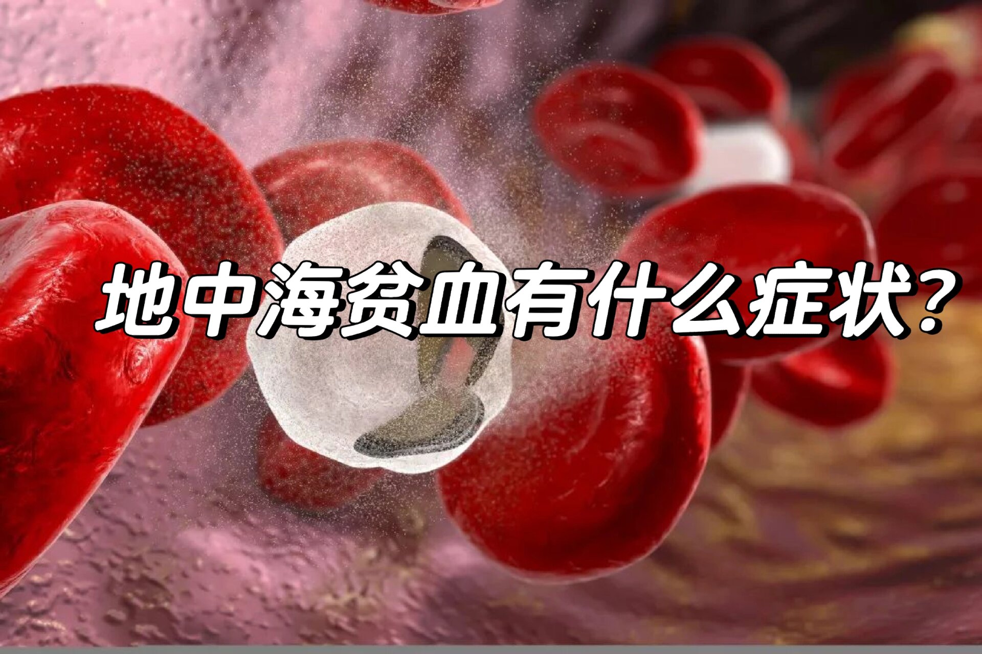 轻度地中海贫血能活多久