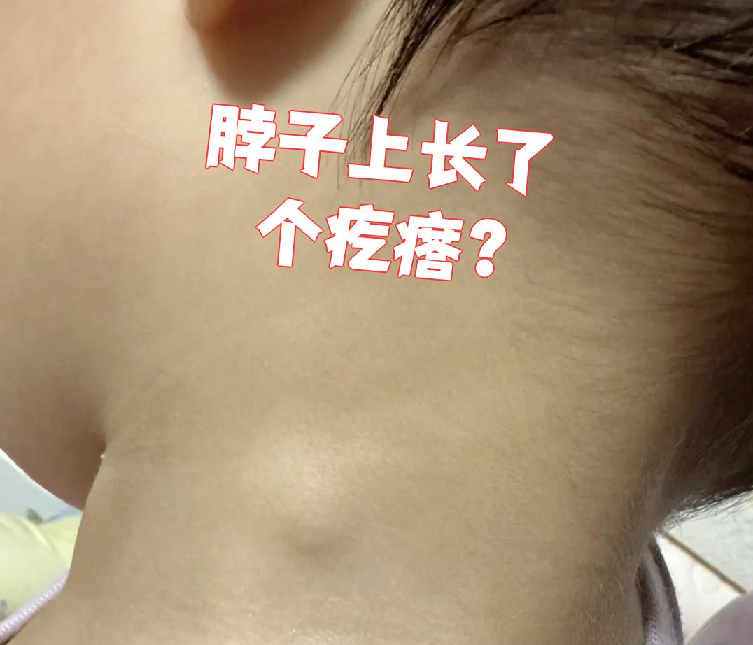 脖子长疙瘩,不疼不痒